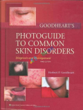 Goodheart's Photoguide to Common Skin Disorders: Diagnosis and Management (Color)