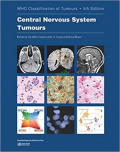 Central Nervous System Tumours (Color)
