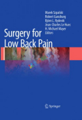Surgery for Low Back Pain (Color)