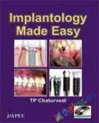 Implantology Made Easy with DVD-ROM