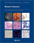 WHO Breast Tumours (Color)