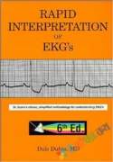 Rapid Interpretation of EKG's (eco)